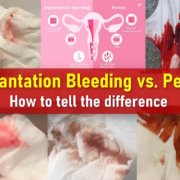 Implantation Bleeding vs. Period, how to tell the difference. Pictures, colors, implantation bleeding pictures